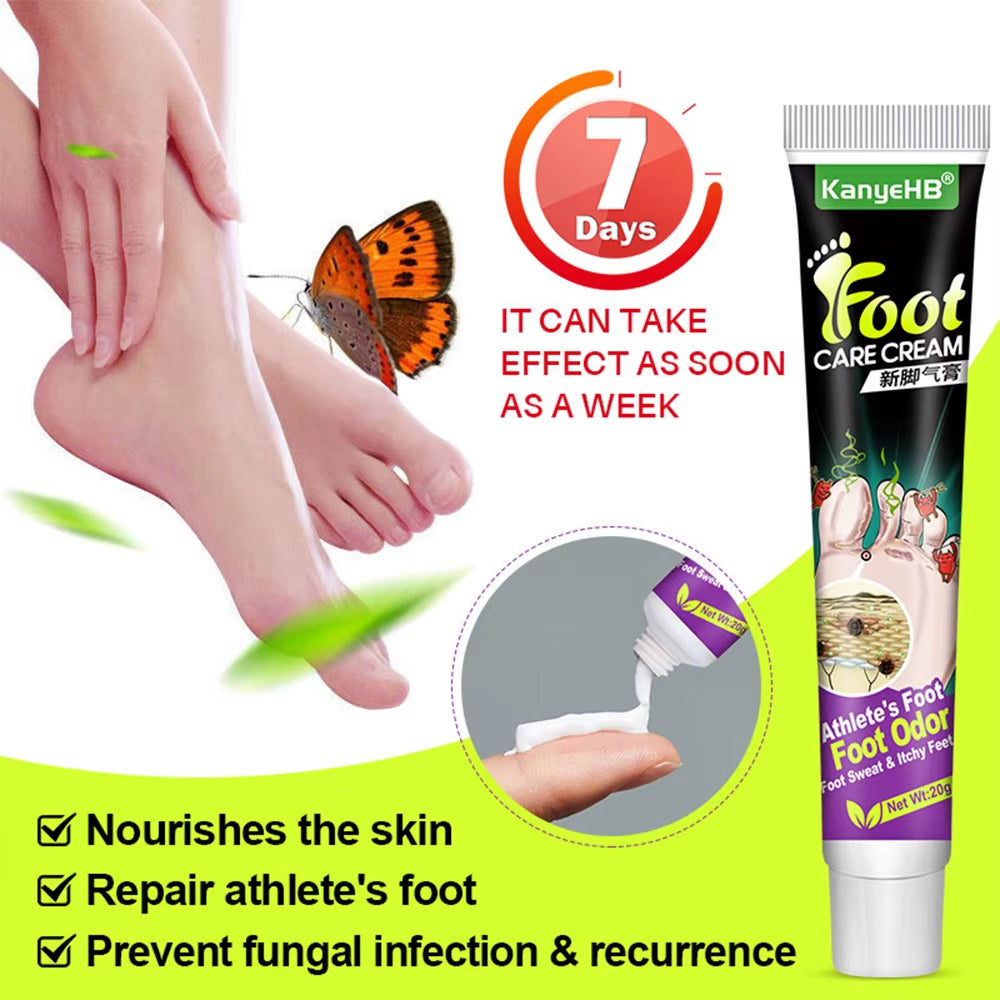 Foot Beriberi Treatment Cream for Foot Odor Tinea Pedis Anti-Itch Inhibits Fungus Athlete Foot Care Medical Ointment Cream